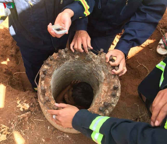 giai cuu chau be mac ket nhieu gio trong ong tru dien cu hinh 1