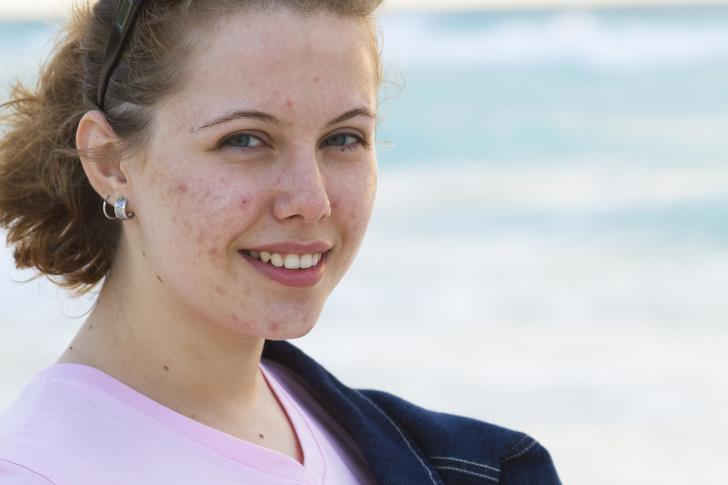 7 dấu hiệu cho thấy bạn đang bị thiếu vitamin A - 3