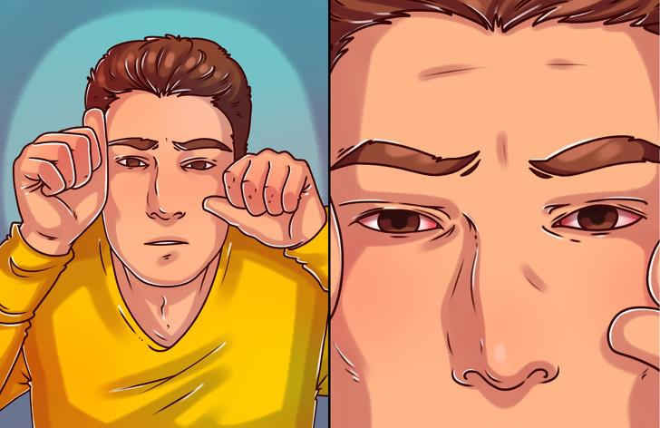 7 dấu hiệu cho thấy bạn đang bị thiếu vitamin A - 7