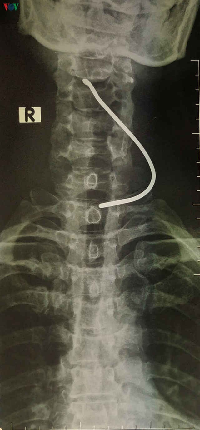 xe o to no lop lam ban thanh sat tren duong cam vao co nguoi dan ong hinh 1