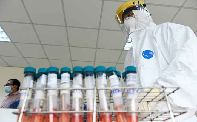 Đi xét nghiệm dịch vụ phát hiện SARS-CoV-2 ở đâu là chuẩn nhất, mức phí bao nhiêu? - Ảnh 1 Đi xét nghiệm dịch vụ phát hiện SARS-CoV-2 ở đâu là chuẩn nhất, mức phí bao nhiêu? - Ảnh 1