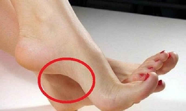 Soi tướng bàn chân 'thiên kim', một bước đi một dặm giàu, viên mãn cả tình lẫn tiền