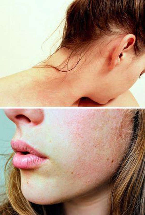 Đi ngủ với mái tóc ẩm, bạn sẽ phải chịu 8 hậu quả chẳng một ai mong muốn này - Ảnh 7 Đi ngủ với mái tóc ẩm, bạn sẽ phải chịu 8 hậu quả chẳng một ai mong muốn này - Ảnh 7