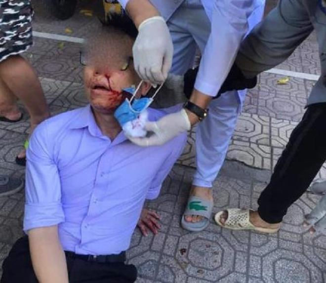 Cán bộ tố cáo tiêu cực bị đánh: Nguyên chủ tịch phường xin thôi nhiều nhiệm vụ - 1