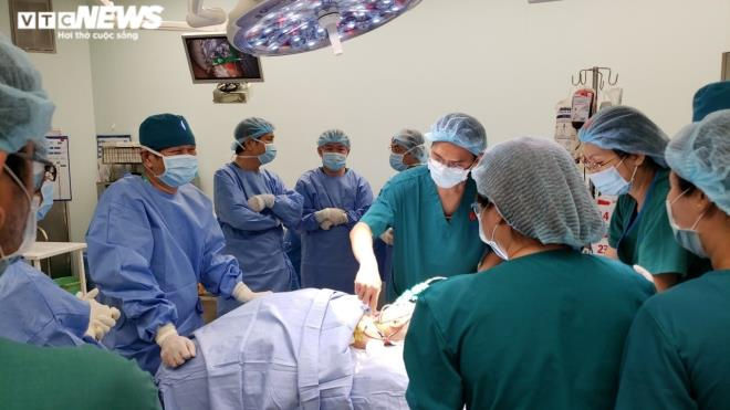 Ảnh: Khoảnh khắc t&aacute;ch rời cặp song sinh d&iacute;nh liền - 1