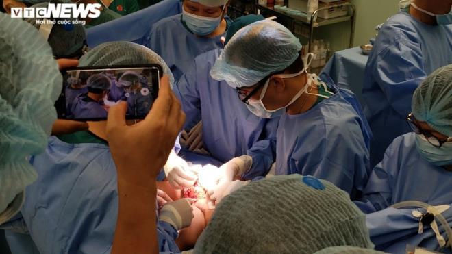 Ảnh: Khoảnh khắc t&aacute;ch rời cặp song sinh d&iacute;nh liền - 2