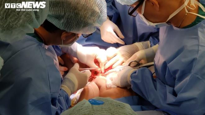 Ảnh: Khoảnh khắc t&aacute;ch rời cặp song sinh d&iacute;nh liền - 3