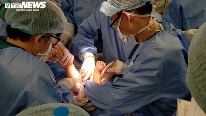 Ảnh: Khoảnh khắc t&aacute;ch rời cặp song sinh d&iacute;nh liền - 5