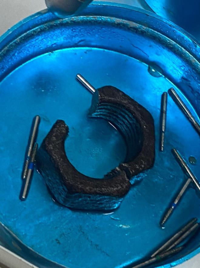 Nhập viện vì tự nhét 'cậu nhỏ' vào chiếc đai ốc lục giác - 1