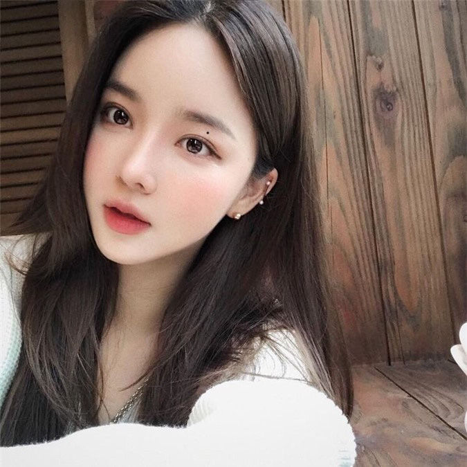 6 nốt ruồi cực hiếm, phụ nữ nào sở hữu thì cả đời sống trong nhung lụa, tiền tiêu ba đời không hết - Ảnh 1
