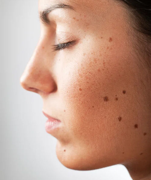 Các bất thường nhỏ trên gương mặt hé lộ các bệnh nguy hiểm - Ảnh 1 Các bất thường nhỏ trên gương mặt hé lộ các bệnh nguy hiểm - Ảnh 1