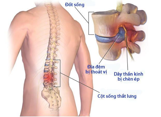 Công dụng của cây mần ri trong đời sống - Ảnh 3 cong dung cua cay man ri 3
