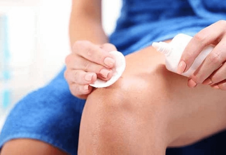 Cách chữa áp xe sau khi tiêm với các bước đơn giản - Ảnh 3 cach chua ap xe sau khi tiem 3