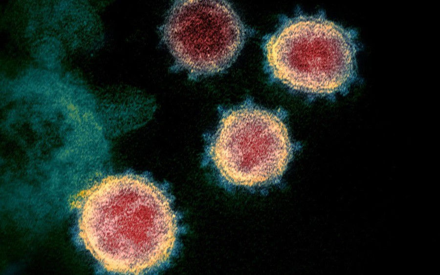 chung virus sars-cov-2 gay covid-19 tai australia la loai de lay nhiem hinh 1