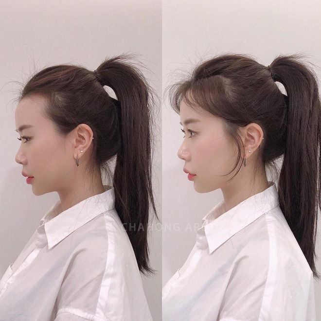 Nếu thường xuyên 'hành hạ' mái tóc theo những cách này, đừng hỏi tại sao tóc rụng cả nắm, hói đầu trong nháy mắt - Ảnh 1 Nếu thường xuyên 'hành hạ' mái tóc theo những cách này, đừng hỏi tại sao tóc rụng cả nắm, hói đầu trong nháy mắt - Ảnh 1