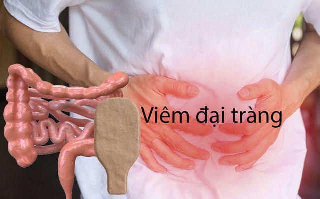 Căn bệnh Thủ tướng Nhật Bản Shinzo Abe mắc phải trước khi từ chức nguy hiểm thế nào? - Ảnh 2 Căn bệnh Thủ tướng Nhật Bản Shinzo Abe mắc phải trước khi từ chức nguy hiểm thế nào? - 3