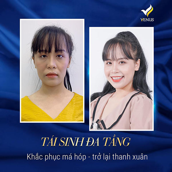 Thẩm mỹ viện Quốc tế Venus và những câu chuyện chưa kể - Ảnh 3