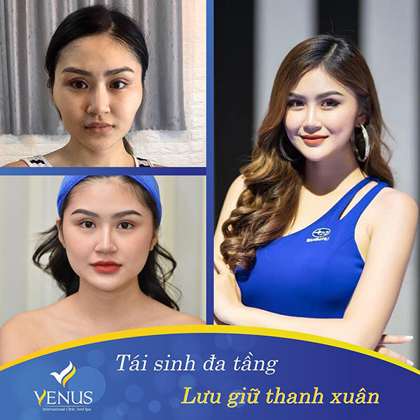Thẩm mỹ viện Quốc tế Venus và những câu chuyện chưa kể - Ảnh 4